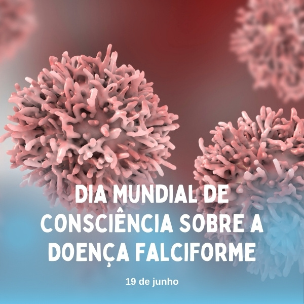 Células estaminais: a primeira linha de tratamento para a forma grave de anemia falciforme