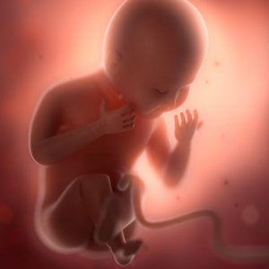 Uma amostra de sangue do cordão umbilical identifica se um tipo de leucemia infantil já estava presente no desenvolvimento fetal