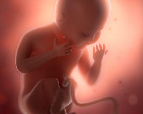 Uma amostra de sangue do cordão umbilical identifica se um tipo de leucemia infantil já estava presente no desenvolvimento fetal