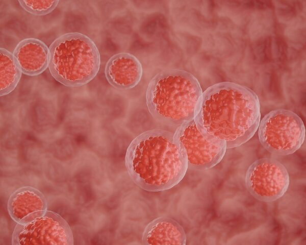 Células do cordão umbilical podem criar um sistema imunológico melhor contra o cancro - 99