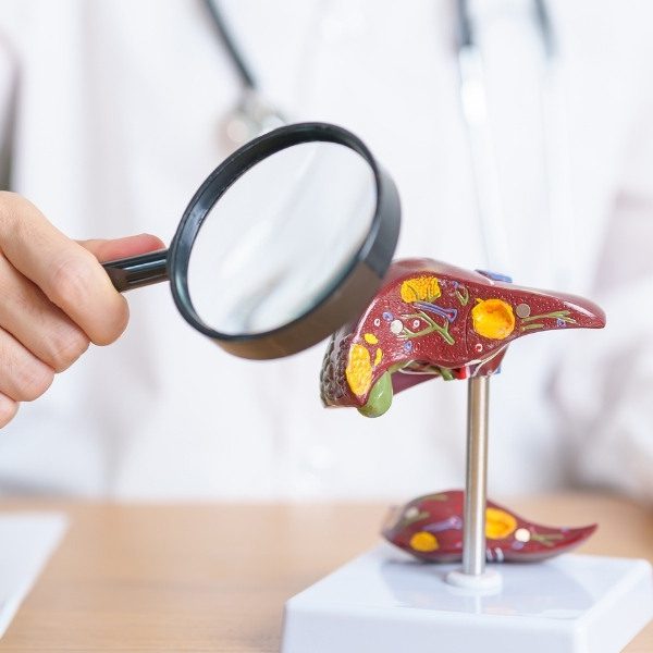 Fatores solúveis derivados de células estaminais para regeneração do fígado - 99