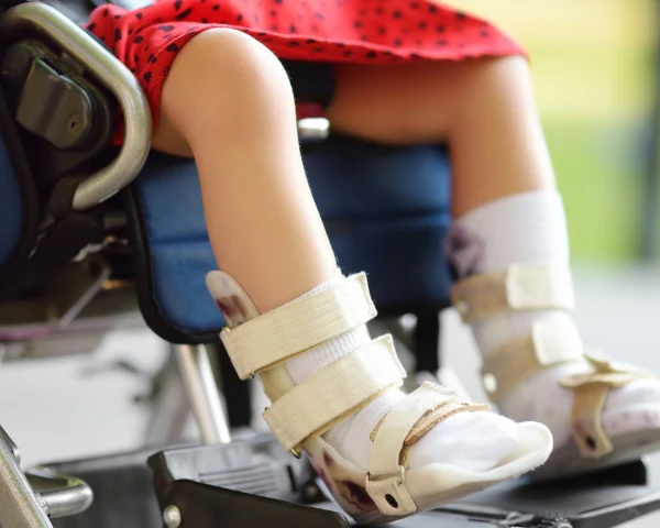 Primeiro tratamento inovador com sangue do cordão umbilical para Paralisia Cerebral na Austrália