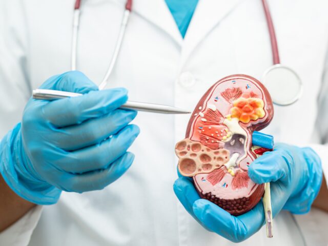 Células estaminais criam tecido ureteral: um passo na direção à criação de rins transplantáveis