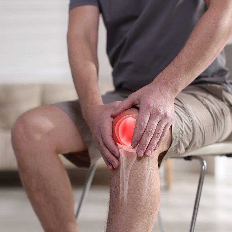 Células estaminais do cordão umbilical no tratamento da osteoartrose Um estudo científico recente demonstrou que as células estaminais mesenquimais do cordão umbilical podem ter potencial terapêutico no tratamento da osteoartrose, uma doença articular degenerativa muito comum, sobretudo em idades mais avançadas. A investigação analisou o efeito combinado destas células com plasma rico em plaquetas (PRP) e com vesículas extracelulares, pequenas estruturas libertadas pelas células que desempenham um papel fundamental na comunicação celular e na regeneração dos tecidos. Os resultados indicam que esta abordagem pode contribuir para a proteção da cartilagem, redução da inflamação e melhoria da função articular. No estudo, verificou-se que o PRP estimula a capacidade de diferenciação das células estaminais do cordão umbilical, mantendo as suas características biológicas. Por outro lado, as vesículas extracelulares libertadas por estas células demonstraram efeitos positivos num modelo experimental de osteoartrose, incluindo aumento da produção de colagénio tipo II e agrecano, componentes essenciais da cartilagem saudável, e diminuição de marcadores inflamatórios, como a interleucina-1 beta. Os investigadores observaram ainda melhorias significativas na mobilidade articular e na recuperação da cartilagem, sugerindo que estas vesículas extracelulares poderão funcionar como uma terapia regenerativa sem recurso à transplantação direta de células, o que representa uma abordagem inovadora e com menor risco imunológico. Este trabalho reforça o interesse científico nas células estaminais do cordão umbilical, um recurso biológico habitualmente descartado após o nascimento, mas que apresenta elevado potencial em medicina regenerativa. Apesar de os resultados serem promissores, os autores sublinham que são necessários mais estudos clínicos e acompanhamento a longo prazo para confirmar a eficácia e segurança destas estratégias em humanos. Ainda assim, esta investigação abre novas perspetivas para o desenvolvimento de terapias mais eficazes e personalizadas no tratamento da osteoartrose e de outras doenças degenerativas das articulações.