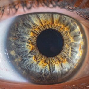 Células estaminais utilizadas no tratamento de doenças da retina Um estudo científico publicado recentemente na plataforma PubMed Central analisou os avanços mais recentes na utilização de células estaminais para o tratamento de doenças degenerativas da retina, abrindo novas perspectivas para o futuro da medicina regenerativa e da recuperação da visão. As doenças da retina, como a degenerescência macular relacionada com a idade, a retinite pigmentosa e a doença de Stargardt, são atualmente responsáveis por uma grande parte dos casos de perda visual progressiva e, na maioria das situações, não têm cura definitiva. Por este motivo, a investigação científica tem vindo a apostar em abordagens inovadoras baseadas em terapias celulares. O estudo destaca a utilização de células estaminais pluripotentes, capazes de se diferenciar em células especializadas da retina, como uma das estratégias mais promissoras para substituir ou regenerar tecidos danificados e, potencialmente, restaurar funções visuais comprometidas. Entre os avanços identificados estão o desenvolvimento de organoides retinianos, novos métodos de diferenciação celular e técnicas de transplante cada vez mais precisas, que permitem melhorar a integração das células na retina após a sua aplicação. Alguns ensaios clínicos iniciais já demonstram resultados encorajadores, com sinais de melhoria funcional em determinados grupos de doentes. Apesar destes progressos, os investigadores sublinham que ainda existem desafios importantes a ultrapassar, nomeadamente no que diz respeito à segurança, estabilidade das células transplantadas e resposta imunológica, sendo necessários mais estudos antes que estas terapias possam ser amplamente utilizadas na prática clínica. Em conclusão, este trabalho reforça o papel das células estaminais como uma das áreas mais promissoras da medicina regenerativa, com potencial para transformar o tratamento de doenças oculares e melhorar significativamente a qualidade de vida de milhares de pessoas no futuro.