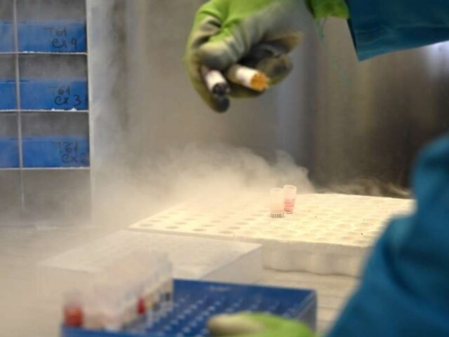 Investigação com células do cordão umbilical em doenças raras As células estaminais do sangue do cordão umbilical são já uma realidade terapêutica em diversas patologias e continuam a ser estudadas em muitas outras onde ainda não existe uma opção de tratamento eficaz. A sua capacidade de regenerar o sistema sanguíneo e imunológico tornou-as uma ferramenta essencial, especialmente no contexto das doenças raras, muitas delas de origem genética ou metabólica. Uma opção com potencial crescente As doenças raras afetam um número reduzido de pessoas, mas, no seu conjunto, impactam milhões em todo o mundo. Muitas destas doenças não têm ainda cura, o que torna a investigação científica fundamental. Neste contexto, as células do cordão umbilical têm ganho destaque, uma vez que: Podem diferenciar-se em vários tipos de células Têm elevada capacidade de regeneração Apresentam menor risco de rejeição em comparação com outras fontes Aplicações atuais e em estudo Atualmente, estas células já são utilizadas no tratamento de várias doenças, sobretudo: Doenças hematológicas Algumas doenças do sistema imunitário Além disso, estão em investigação aplicações em: Doenças neurológicas Patologias metabólicas raras Condições degenerativas Os estudos continuam a demonstrar resultados promissores, abrindo caminho a novas abordagens terapêuticas. O futuro da investigação A ciência continua a avançar rapidamente nesta área. Cada novo estudo contribui para: Melhor compreensão das doenças raras Desenvolvimento de terapias inovadoras Aumento das possibilidades de tratamento para pacientes sem alternativas Assim, a criopreservação do sangue do cordão umbilical assume um papel cada vez mais relevante como uma potencial ferramenta para o futuro da medicina.