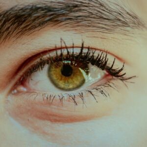 Células do cordão umbilical: Potencial no tratamento da neuromielite óptica A neuromielite óptica é uma doença rara do sistema nervoso central, caracterizada por inflamação do nervo óptico e da medula espinal, podendo provocar perda de visão e dificuldades motoras significativas. Atualmente, as opções terapêuticas disponíveis são limitadas e focam-se sobretudo no controlo da resposta imunitária e na prevenção de recaídas. Neste contexto, a investigação tem vindo a explorar novas abordagens, nomeadamente a utilização de células estaminais mesenquimais derivadas do cordão umbilical. Estudos recentes sugerem que estas células poderão desempenhar um papel relevante na modulação da resposta imunitária e na redução dos processos inflamatórios associados à doença. De acordo com os dados analisados, a terapia com células do cordão umbilical poderá contribuir para: reduzir a inflamação no sistema nervoso central proteger as estruturas nervosas afetadas promover mecanismos de reparação tecidual Estas propriedades tornam esta abordagem particularmente interessante em doenças autoimunes e inflamatórias como a neuromielite óptica. Apesar dos resultados encorajadores, esta estratégia encontra-se ainda em fase de investigação, sendo necessários mais estudos clínicos para confirmar a sua segurança e eficácia a longo prazo. A utilização de células estaminais do cordão umbilical representa uma abordagem promissora no tratamento de doenças neurológicas raras, abrindo novas perspetivas para terapias mais direcionadas e eficazes.