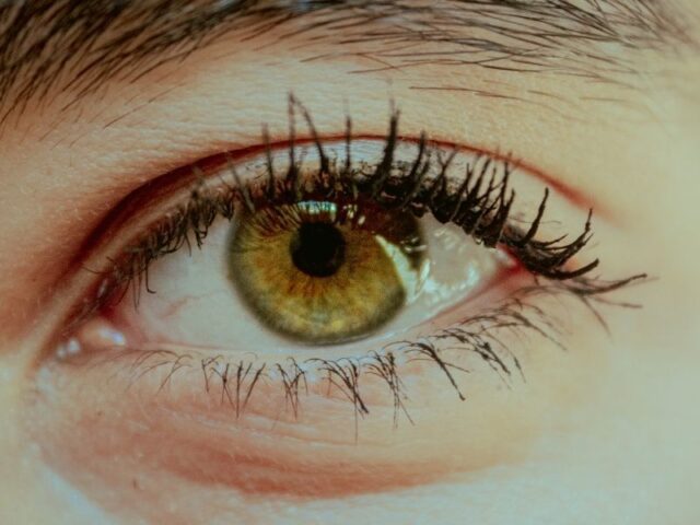 Células do cordão umbilical: Potencial no tratamento da neuromielite óptica A neuromielite óptica é uma doença rara do sistema nervoso central, caracterizada por inflamação do nervo óptico e da medula espinal, podendo provocar perda de visão e dificuldades motoras significativas. Atualmente, as opções terapêuticas disponíveis são limitadas e focam-se sobretudo no controlo da resposta imunitária e na prevenção de recaídas. Neste contexto, a investigação tem vindo a explorar novas abordagens, nomeadamente a utilização de células estaminais mesenquimais derivadas do cordão umbilical. Estudos recentes sugerem que estas células poderão desempenhar um papel relevante na modulação da resposta imunitária e na redução dos processos inflamatórios associados à doença. De acordo com os dados analisados, a terapia com células do cordão umbilical poderá contribuir para: reduzir a inflamação no sistema nervoso central proteger as estruturas nervosas afetadas promover mecanismos de reparação tecidual Estas propriedades tornam esta abordagem particularmente interessante em doenças autoimunes e inflamatórias como a neuromielite óptica. Apesar dos resultados encorajadores, esta estratégia encontra-se ainda em fase de investigação, sendo necessários mais estudos clínicos para confirmar a sua segurança e eficácia a longo prazo. A utilização de células estaminais do cordão umbilical representa uma abordagem promissora no tratamento de doenças neurológicas raras, abrindo novas perspetivas para terapias mais direcionadas e eficazes.