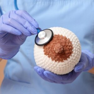 Exossomas do cordão umbilical nova abordagem promissora no tratamento do cancro da mama O cancro da mama continua a ser, a nível mundial, o tipo de cancro com maior incidência e mortalidade entre as mulheres. Apesar dos avanços registados na oncologia nas últimas décadas, persistem desafios importantes, sobretudo no que diz respeito aos efeitos secundários da quimioterapia convencional e à resistência de algumas células tumorais aos tratamentos disponíveis. Neste contexto, os exossomas isolados de células estaminais mesenquimais, em particular os derivados do cordão umbilical humano, têm vindo a destacar-se como uma abordagem inovadora em investigação. Estas pequenas vesículas apresentam características que as tornam especialmente promissoras do ponto de vista terapêutico, nomeadamente elevada compatibilidade biológica, baixa imunogenicidade e capacidade de atravessar barreiras fisiológicas e anatómicas. Estas propriedades permitem-lhes atuar como veículos para o transporte de agentes terapêuticos, como fármacos quimioterápicos, microARN e outros compostos bioativos. De acordo com os dados disponíveis, os exossomas derivados do tecido do cordão umbilical poderão atuar em múltiplas vias de sinalização em simultâneo, contribuindo para inibir o crescimento e a progressão tumoral. Estudos pré-clínicos indicam ainda que podem reduzir a migração e invasão das células tumorais, induzir a morte celular e modular a resposta imunitária. Esta abordagem poderá representar uma nova oportunidade para o desenvolvimento de terapias mais direcionadas no tratamento do cancro da mama, especialmente tendo em conta as limitações das opções terapêuticas atuais. No entanto, continuam a existir desafios relevantes à sua aplicação clínica. Entre eles destacam-se a ausência de métodos padronizados para o isolamento de exossomas, a variabilidade na sua produção e composição e a necessidade de aprofundar o conhecimento sobre o seu comportamento biológico, uma vez que, em determinados contextos, poderão também ter um papel na promoção tumoral. Apesar destas limitações, os exossomas derivados do cordão umbilical surgem como uma abordagem promissora no desenvolvimento de terapias acelulares com potencial antitumoral. Nota: o estudo referido não foi realizado com sangue do cordão umbilical para uso autólogo eventual. Segundo a Sociedade Espanhola de Hematologia e Hemoterapia, a probabilidade de utilização de uma unidade de sangue do cordão autólogo para transplante é atualmente reduzida e não existe ainda evidência clara da sua aplicação futura em medicina regenerativa fora das indicações atualmente estabelecidas.