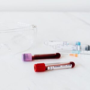 A ciência acaba de dar um passo muito relevante no tratamento de doenças do sangue, com novos dados promissores sobre a utilização do sangue do cordão umbilical em transplantes de células estaminais. Um ensaio clínico de fase 2, publicado no Journal of Clinical Oncology, demonstrou que uma abordagem inovadora de transplante permitiu alcançar resultados muito encorajadores: 27 em 28 doentes sobreviveram ao primeiro ano após o tratamento e nenhum desenvolveu doença grave do enxerto contra o hospedeiro, uma das complicações mais temidas neste tipo de procedimento. O estudo envolveu doentes com leucemias e síndrome mielodisplásica, doenças hematológicas que, em muitos casos, podem exigir um transplante de células estaminais. No entanto, encontrar um dador compatível continua a ser um desafio para muitos doentes, especialmente para pessoas com origens étnicas mistas ou menos representadas nos registos internacionais de dadores. É aqui que o sangue do cordão umbilical assume um papel particularmente importante. Ao contrário de outras fontes de células estaminais hematopoiéticas, o sangue do cordão pode, em determinadas situações, exigir uma compatibilidade menos rigorosa entre dador e recetor. Esta característica torna-o uma alternativa relevante para doentes que não encontram um dador totalmente compatível. O que torna esta abordagem inovadora? A nova técnica estudada combina uma unidade de sangue do cordão umbilical com um produto celular experimental chamado dilanubicel. Este produto é desenvolvido a partir de células estaminais progenitoras recolhidas de seis a oito unidades de sangue do cordão umbilical de dadores diferentes, que são depois expandidas em laboratório. Segundo os investigadores, esta estratégia pode ajudar a ultrapassar uma das principais limitações históricas do sangue do cordão umbilical: a quantidade reduzida de células disponível numa única unidade, sobretudo quando o transplante é realizado em adultos. O dilanubicel não tem como objetivo substituir a unidade principal de sangue do cordão, mas sim apoiar o organismo numa fase inicial crítica, ajudando na recuperação enquanto as células transplantadas se estabelecem e começam a regenerar o sistema sanguíneo e imunitário. Porque é que este estudo é importante? Os resultados são particularmente relevantes porque mostram que a investigação continua a encontrar novas formas de potenciar o uso do sangue do cordão umbilical em contexto clínico. No final do acompanhamento, praticamente todos os participantes estavam vivos e em remissão, o que reforça o interesse desta abordagem para doentes com doenças hematológicas graves. Apesar destes dados promissores, é importante sublinhar que se trata ainda de uma terapia experimental. Serão necessários estudos adicionais, com mais participantes e acompanhamento a longo prazo, para confirmar a segurança e eficácia desta estratégia. Ainda assim, este avanço representa mais um exemplo do potencial das células estaminais do sangue do cordão umbilical e da importância da investigação contínua nesta área.