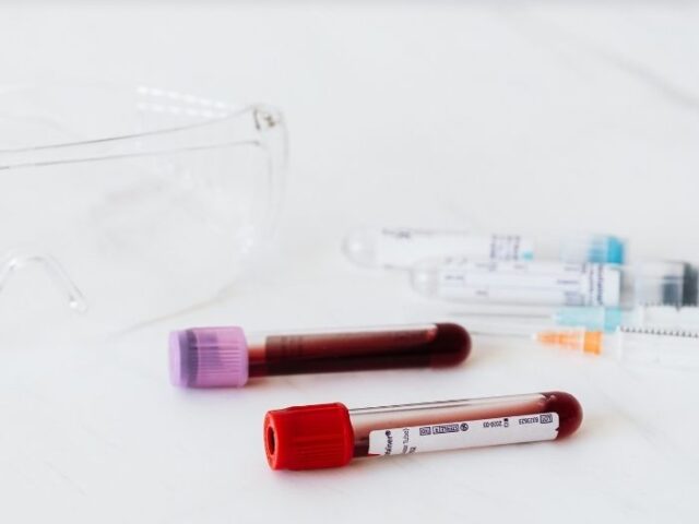 A ciência acaba de dar um passo muito relevante no tratamento de doenças do sangue, com novos dados promissores sobre a utilização do sangue do cordão umbilical em transplantes de células estaminais. Um ensaio clínico de fase 2, publicado no Journal of Clinical Oncology, demonstrou que uma abordagem inovadora de transplante permitiu alcançar resultados muito encorajadores: 27 em 28 doentes sobreviveram ao primeiro ano após o tratamento e nenhum desenvolveu doença grave do enxerto contra o hospedeiro, uma das complicações mais temidas neste tipo de procedimento. O estudo envolveu doentes com leucemias e síndrome mielodisplásica, doenças hematológicas que, em muitos casos, podem exigir um transplante de células estaminais. No entanto, encontrar um dador compatível continua a ser um desafio para muitos doentes, especialmente para pessoas com origens étnicas mistas ou menos representadas nos registos internacionais de dadores. É aqui que o sangue do cordão umbilical assume um papel particularmente importante. Ao contrário de outras fontes de células estaminais hematopoiéticas, o sangue do cordão pode, em determinadas situações, exigir uma compatibilidade menos rigorosa entre dador e recetor. Esta característica torna-o uma alternativa relevante para doentes que não encontram um dador totalmente compatível. O que torna esta abordagem inovadora? A nova técnica estudada combina uma unidade de sangue do cordão umbilical com um produto celular experimental chamado dilanubicel. Este produto é desenvolvido a partir de células estaminais progenitoras recolhidas de seis a oito unidades de sangue do cordão umbilical de dadores diferentes, que são depois expandidas em laboratório. Segundo os investigadores, esta estratégia pode ajudar a ultrapassar uma das principais limitações históricas do sangue do cordão umbilical: a quantidade reduzida de células disponível numa única unidade, sobretudo quando o transplante é realizado em adultos. O dilanubicel não tem como objetivo substituir a unidade principal de sangue do cordão, mas sim apoiar o organismo numa fase inicial crítica, ajudando na recuperação enquanto as células transplantadas se estabelecem e começam a regenerar o sistema sanguíneo e imunitário. Porque é que este estudo é importante? Os resultados são particularmente relevantes porque mostram que a investigação continua a encontrar novas formas de potenciar o uso do sangue do cordão umbilical em contexto clínico. No final do acompanhamento, praticamente todos os participantes estavam vivos e em remissão, o que reforça o interesse desta abordagem para doentes com doenças hematológicas graves. Apesar destes dados promissores, é importante sublinhar que se trata ainda de uma terapia experimental. Serão necessários estudos adicionais, com mais participantes e acompanhamento a longo prazo, para confirmar a segurança e eficácia desta estratégia. Ainda assim, este avanço representa mais um exemplo do potencial das células estaminais do sangue do cordão umbilical e da importância da investigação contínua nesta área.
