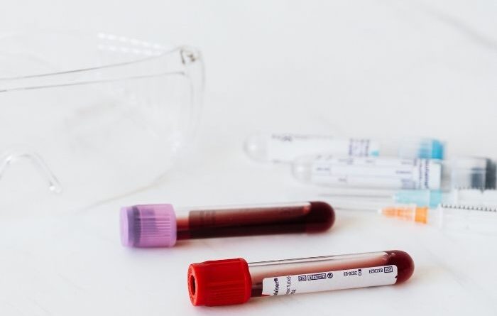 A ciência acaba de dar um passo muito relevante no tratamento de doenças do sangue, com novos dados promissores sobre a utilização do sangue do cordão umbilical em transplantes de células estaminais. Um ensaio clínico de fase 2, publicado no Journal of Clinical Oncology, demonstrou que uma abordagem inovadora de transplante permitiu alcançar resultados muito encorajadores: 27 em 28 doentes sobreviveram ao primeiro ano após o tratamento e nenhum desenvolveu doença grave do enxerto contra o hospedeiro, uma das complicações mais temidas neste tipo de procedimento. O estudo envolveu doentes com leucemias e síndrome mielodisplásica, doenças hematológicas que, em muitos casos, podem exigir um transplante de células estaminais. No entanto, encontrar um dador compatível continua a ser um desafio para muitos doentes, especialmente para pessoas com origens étnicas mistas ou menos representadas nos registos internacionais de dadores. É aqui que o sangue do cordão umbilical assume um papel particularmente importante. Ao contrário de outras fontes de células estaminais hematopoiéticas, o sangue do cordão pode, em determinadas situações, exigir uma compatibilidade menos rigorosa entre dador e recetor. Esta característica torna-o uma alternativa relevante para doentes que não encontram um dador totalmente compatível. O que torna esta abordagem inovadora? A nova técnica estudada combina uma unidade de sangue do cordão umbilical com um produto celular experimental chamado dilanubicel. Este produto é desenvolvido a partir de células estaminais progenitoras recolhidas de seis a oito unidades de sangue do cordão umbilical de dadores diferentes, que são depois expandidas em laboratório. Segundo os investigadores, esta estratégia pode ajudar a ultrapassar uma das principais limitações históricas do sangue do cordão umbilical: a quantidade reduzida de células disponível numa única unidade, sobretudo quando o transplante é realizado em adultos. O dilanubicel não tem como objetivo substituir a unidade principal de sangue do cordão, mas sim apoiar o organismo numa fase inicial crítica, ajudando na recuperação enquanto as células transplantadas se estabelecem e começam a regenerar o sistema sanguíneo e imunitário. Porque é que este estudo é importante? Os resultados são particularmente relevantes porque mostram que a investigação continua a encontrar novas formas de potenciar o uso do sangue do cordão umbilical em contexto clínico. No final do acompanhamento, praticamente todos os participantes estavam vivos e em remissão, o que reforça o interesse desta abordagem para doentes com doenças hematológicas graves. Apesar destes dados promissores, é importante sublinhar que se trata ainda de uma terapia experimental. Serão necessários estudos adicionais, com mais participantes e acompanhamento a longo prazo, para confirmar a segurança e eficácia desta estratégia. Ainda assim, este avanço representa mais um exemplo do potencial das células estaminais do sangue do cordão umbilical e da importância da investigação contínua nesta área.