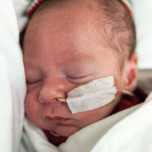 Estudo avalia células do cordão umbilical na displasia broncopulmonar A investigação com células estaminais do cordão umbilical continua a abrir novas possibilidades na medicina regenerativa. Um estudo clínico de fase 1, publicado na revista científica Cytotherapy, avaliou a administração intravenosa de células estaminais mesenquimais derivadas do tecido do cordão umbilical em bebés extremamente prematuros com elevado risco de desenvolver displasia broncopulmonar. A displasia broncopulmonar é uma doença pulmonar crónica que pode afetar recém-nascidos prematuros, sobretudo aqueles que nascem muito antes do tempo, com baixo peso e que necessitam de suporte respiratório ou ventilação mecânica nos primeiros dias de vida. Nestes bebés, os pulmões ainda se encontram em desenvolvimento e podem ser particularmente vulneráveis à inflamação, ao oxigénio e à ventilação necessária para garantir a sobrevivência. Apesar dos avanços nos cuidados neonatais, continua a existir uma necessidade significativa de novas estratégias que possam ajudar a proteger ou reparar o pulmão imaturo. É neste contexto que as células estaminais mesenquimais, nomeadamente as obtidas a partir do tecido do cordão umbilical, têm despertado interesse na comunidade científica. O que avaliou este estudo? O estudo analisou a segurança e a viabilidade da administração de três doses intravenosas sequenciais de células estaminais mesenquimais derivadas do tecido do cordão umbilical em recém-nascidos extremamente prematuros. Foram incluídos 10 bebés com idade gestacional igual ou inferior a 28 semanas e peso ao nascimento igual ou inferior a 1250 gramas. Todos necessitavam de ventilação mecânica invasiva e apresentavam elevado risco de desenvolver displasia broncopulmonar. Cada bebé recebeu três administrações intravenosas, com intervalo de sete dias entre cada dose. O objetivo principal dos investigadores não foi demonstrar a eficácia do tratamento, mas sim perceber se esta abordagem era segura, exequível e bem tolerada neste grupo particularmente vulnerável. Quais foram os principais resultados? De acordo com os autores, todos os bebés incluídos no estudo receberam as três doses previstas. A primeira administração ocorreu, em média, por volta do 16.º dia de vida. Durante o período de administração, durante o internamento hospitalar e ao longo do seguimento de dois anos, não foram observadas mortes nem eventos adversos graves relacionados com a infusão das células. Todos os bebés tiveram alta hospitalar. Embora todos os participantes tenham sido posteriormente diagnosticados com displasia broncopulmonar, os resultados sugerem que a administração repetida destas células foi possível e segura no curto e médio prazo. Porque é que o tecido do cordão umbilical é tão relevante? O tecido do cordão umbilical é uma fonte rica em células estaminais mesenquimais. Estas células são estudadas pelo seu potencial imunomodulador, anti-inflamatório e regenerativo, características que as tornam particularmente interessantes em áreas como a medicina pulmonar, neurológica, ortopédica e imunológica. Ao contrário das células estaminais hematopoiéticas, presentes sobretudo no sangue do cordão umbilical e utilizadas há décadas em transplantes para várias doenças do sangue e do sistema imunitário, as células mesenquimais encontram-se principalmente no tecido do cordão. Por isso, a criopreservação do tecido do cordão umbilical pode representar uma oportunidade importante para acompanhar a evolução da investigação científica nesta área. O que significa este estudo para o futuro? Este estudo representa mais um passo na investigação sobre o potencial terapêutico das células estaminais mesenquimais do tecido do cordão umbilical. No entanto, é importante sublinhar que se trata de um ensaio clínico de fase 1, com um número reduzido de participantes e sem grupo de controlo. Isto significa que os resultados são promissores ao nível da segurança, mas ainda não permitem concluir que esta abordagem seja eficaz no tratamento ou prevenção da displasia broncopulmonar. Para isso, serão necessários estudos maiores, controlados e com avaliação clínica mais alargada. Ainda assim, a investigação reforça a importância do cordão umbilical como uma fonte valiosa de células com potencial biomédico. Aquilo que durante muito tempo foi descartado após o parto é hoje objeto de estudo em múltiplas áreas da medicina regenerativa. Criopreservar hoje para acompanhar a medicina do futuro A criopreservação das células estaminais do sangue e do tecido do cordão umbilical permite conservar um recurso biológico único, recolhido apenas no momento do nascimento. Embora muitas aplicações ainda estejam em fase experimental, cada novo estudo contribui para compreender melhor como estas células poderão vir a ser utilizadas no futuro. A decisão de criopreservar é uma escolha informada, feita num momento único: o nascimento. E a ciência continua a demonstrar que o cordão umbilical pode ter um papel cada vez mais relevante na medicina personalizada e regenerativa. Nota: Este artigo tem finalidade informativa e não substitui o aconselhamento médico. As aplicações clínicas referidas no contexto da displasia broncopulmonar encontram-se em investigação e não devem ser interpretadas como tratamentos aprovados ou garantidos.