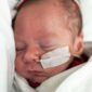 Estudo avalia células do cordão umbilical na displasia broncopulmonar A investigação com células estaminais do cordão umbilical continua a abrir novas possibilidades na medicina regenerativa. Um estudo clínico de fase 1, publicado na revista científica Cytotherapy, avaliou a administração intravenosa de células estaminais mesenquimais derivadas do tecido do cordão umbilical em bebés extremamente prematuros com elevado risco de desenvolver displasia broncopulmonar. A displasia broncopulmonar é uma doença pulmonar crónica que pode afetar recém-nascidos prematuros, sobretudo aqueles que nascem muito antes do tempo, com baixo peso e que necessitam de suporte respiratório ou ventilação mecânica nos primeiros dias de vida. Nestes bebés, os pulmões ainda se encontram em desenvolvimento e podem ser particularmente vulneráveis à inflamação, ao oxigénio e à ventilação necessária para garantir a sobrevivência. Apesar dos avanços nos cuidados neonatais, continua a existir uma necessidade significativa de novas estratégias que possam ajudar a proteger ou reparar o pulmão imaturo. É neste contexto que as células estaminais mesenquimais, nomeadamente as obtidas a partir do tecido do cordão umbilical, têm despertado interesse na comunidade científica. O que avaliou este estudo? O estudo analisou a segurança e a viabilidade da administração de três doses intravenosas sequenciais de células estaminais mesenquimais derivadas do tecido do cordão umbilical em recém-nascidos extremamente prematuros. Foram incluídos 10 bebés com idade gestacional igual ou inferior a 28 semanas e peso ao nascimento igual ou inferior a 1250 gramas. Todos necessitavam de ventilação mecânica invasiva e apresentavam elevado risco de desenvolver displasia broncopulmonar. Cada bebé recebeu três administrações intravenosas, com intervalo de sete dias entre cada dose. O objetivo principal dos investigadores não foi demonstrar a eficácia do tratamento, mas sim perceber se esta abordagem era segura, exequível e bem tolerada neste grupo particularmente vulnerável. Quais foram os principais resultados? De acordo com os autores, todos os bebés incluídos no estudo receberam as três doses previstas. A primeira administração ocorreu, em média, por volta do 16.º dia de vida. Durante o período de administração, durante o internamento hospitalar e ao longo do seguimento de dois anos, não foram observadas mortes nem eventos adversos graves relacionados com a infusão das células. Todos os bebés tiveram alta hospitalar. Embora todos os participantes tenham sido posteriormente diagnosticados com displasia broncopulmonar, os resultados sugerem que a administração repetida destas células foi possível e segura no curto e médio prazo. Porque é que o tecido do cordão umbilical é tão relevante? O tecido do cordão umbilical é uma fonte rica em células estaminais mesenquimais. Estas células são estudadas pelo seu potencial imunomodulador, anti-inflamatório e regenerativo, características que as tornam particularmente interessantes em áreas como a medicina pulmonar, neurológica, ortopédica e imunológica. Ao contrário das células estaminais hematopoiéticas, presentes sobretudo no sangue do cordão umbilical e utilizadas há décadas em transplantes para várias doenças do sangue e do sistema imunitário, as células mesenquimais encontram-se principalmente no tecido do cordão. Por isso, a criopreservação do tecido do cordão umbilical pode representar uma oportunidade importante para acompanhar a evolução da investigação científica nesta área. O que significa este estudo para o futuro? Este estudo representa mais um passo na investigação sobre o potencial terapêutico das células estaminais mesenquimais do tecido do cordão umbilical. No entanto, é importante sublinhar que se trata de um ensaio clínico de fase 1, com um número reduzido de participantes e sem grupo de controlo. Isto significa que os resultados são promissores ao nível da segurança, mas ainda não permitem concluir que esta abordagem seja eficaz no tratamento ou prevenção da displasia broncopulmonar. Para isso, serão necessários estudos maiores, controlados e com avaliação clínica mais alargada. Ainda assim, a investigação reforça a importância do cordão umbilical como uma fonte valiosa de células com potencial biomédico. Aquilo que durante muito tempo foi descartado após o parto é hoje objeto de estudo em múltiplas áreas da medicina regenerativa. Criopreservar hoje para acompanhar a medicina do futuro A criopreservação das células estaminais do sangue e do tecido do cordão umbilical permite conservar um recurso biológico único, recolhido apenas no momento do nascimento. Embora muitas aplicações ainda estejam em fase experimental, cada novo estudo contribui para compreender melhor como estas células poderão vir a ser utilizadas no futuro. A decisão de criopreservar é uma escolha informada, feita num momento único: o nascimento. E a ciência continua a demonstrar que o cordão umbilical pode ter um papel cada vez mais relevante na medicina personalizada e regenerativa. Nota: Este artigo tem finalidade informativa e não substitui o aconselhamento médico. As aplicações clínicas referidas no contexto da displasia broncopulmonar encontram-se em investigação e não devem ser interpretadas como tratamentos aprovados ou garantidos.