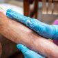 Células do cordão em estudo para uma doença rara da pele Um ensaio clínico publicado em 2025 na revista científica eClinicalMedicine avaliou a segurança e o potencial terapêutico das células estaminais mesenquimais derivadas do tecido do cordão umbilical em crianças com epidermólise bolhosa distrófica recessiva. Esta doença genética rara torna a pele extremamente frágil, provocando bolhas, feridas, cicatrizes, dor e comichão. Embora o estudo não tenha demonstrado melhorias significativas no seu principal indicador de eficácia, confirmou que as células foram bem toleradas e forneceu dados importantes para o desenvolvimento de futuras investigações. O que é a epidermólise bolhosa? A epidermólise bolhosa é um grupo de doenças genéticas raras caracterizadas por uma fragilidade extrema da pele e das mucosas. Nas pessoas afetadas, um pequeno toque ou atrito pode ser suficiente para provocar bolhas e feridas. Uma das formas mais graves é a epidermólise bolhosa distrófica recessiva. Esta doença é causada por alterações genéticas que afetam a produção de colagénio tipo VII, uma proteína essencial para manter unidas as diferentes camadas da pele. As crianças podem apresentar feridas recorrentes, cicatrizes, dor, comichão intensa e dificuldades ao nível da alimentação e da mobilidade. A necessidade constante de cuidados e pensos pode ainda ter um impacto muito significativo na qualidade de vida das crianças e das suas famílias. Atualmente, os cuidados passam sobretudo pelo tratamento das feridas, controlo da dor, prevenção de infeções e acompanhamento das possíveis complicações. Porquê estudar células do cordão umbilical? O tecido do cordão umbilical é uma fonte de células estaminais mesenquimais, também designadas células estromais mesenquimais. Estas células têm sido estudadas pelas suas propriedades imunomoduladoras, anti-inflamatórias e regenerativas. Acredita-se que possam libertar moléculas e fatores de crescimento capazes de reduzir a inflamação, apoiar a cicatrização e contribuir para a reparação dos tecidos. Investigações anteriores sugeriram que a administração intravenosa destas células poderia ajudar a aliviar alguns sintomas da epidermólise bolhosa. No entanto, eram necessários estudos mais robustos e controlados para avaliar a sua segurança e eficácia. Como foi realizado o estudo? O ensaio clínico MissionEB decorreu em dois centros especializados do Reino Unido e envolveu crianças entre os seis meses e os 16 anos com formas intermédias ou graves da doença. No total: 44 crianças foram avaliadas para participar; 37 foram distribuídas aleatoriamente pelos grupos do estudo; 34 receberam pelo menos uma infusão; 30 reuniram os dados necessários para integrar a análise principal. O estudo foi aleatorizado, duplamente cego, controlado por placebo e cruzado. Isto significa que nem as famílias nem as equipas responsáveis pelas avaliações sabiam inicialmente se cada criança estava a receber as células ou o placebo. As crianças receberam duas infusões intravenosas, com 14 dias de intervalo, de células mesenquimais derivadas do tecido do cordão umbilical ou de um placebo. Depois de um intervalo definido no protocolo, os grupos trocaram de intervenção, permitindo que os participantes recebessem ambos em momentos diferentes. Esta metodologia ajudou os investigadores a comparar os resultados do tratamento com os do placebo de uma forma mais rigorosa. Quais foram os resultados? O estudo demonstrou que as infusões foram bem toleradas. Na fase inicial de avaliação não foram identificadas toxicidades inesperadas graves associadas ao tratamento. O principal objetivo relacionado com a eficácia era avaliar se existia uma redução da gravidade da doença, medida através do Índice de Atividade e Cicatrização da Epidermólise Bolhosa, conhecido como EBDASI. Aos três meses, não foram observadas diferenças favoráveis às células estaminais neste indicador principal, quando comparadas com o placebo. Assim, o estudo não demonstrou que o tratamento reduzisse de forma significativa a gravidade global da doença. Algumas análises exploratórias e relatos dos participantes e cuidadores sugeriram possíveis melhorias em sintomas como a comichão, a dor, o estado da pele e o bem-estar quotidiano de algumas crianças. Contudo, estes sinais não são suficientes para confirmar a eficácia do tratamento e deverão ser investigados em novos estudos. Porque é importante este estudo? Mesmo quando um ensaio clínico não alcança o seu principal objetivo de eficácia, os seus resultados podem representar um contributo importante para a ciência. O MissionEB é o maior estudo de terapia celular realizado até ao momento em crianças com epidermólise bolhosa distrófica recessiva. Além de fornecer informação relevante sobre a segurança das células mesenquimais do cordão umbilical, permitiu avaliar de forma mais rigorosa os possíveis benefícios e limitações desta abordagem. Os investigadores destacam também uma dificuldade frequente nos estudos sobre doenças raras: o reduzido número de participantes e a falta de instrumentos totalmente adequados para medir alterações que sejam verdadeiramente relevantes para os doentes. Algumas melhorias sentidas pelas crianças e pelas famílias, como dormir melhor, sentir menos comichão ou conseguir participar mais facilmente nas atividades diárias, podem não ser totalmente captadas pelos indicadores clínicos utilizados. Um caminho que continua em investigação Os resultados não permitem considerar esta terapia um tratamento comprovado para a epidermólise bolhosa. No entanto, demonstram que a administração intravenosa destas células foi segura nas condições avaliadas e ajudam a orientar os próximos passos da investigação. Estão previstas avaliações adicionais para perceber se a administração mais precoce ou repetida poderá ter efeitos diferentes e se determinados grupos de crianças poderão beneficiar mais desta abordagem. Este estudo reforça a importância da investigação clínica rigorosa para compreender o verdadeiro potencial das células estaminais do cordão umbilical, especialmente em doenças raras para as quais continuam a existir poucas opções terapêuticas. As células estaminais mesenquimais descritas neste estudo foram obtidas a partir do tecido do cordão umbilical. Esta aplicação permanece experimental e não constitui atualmente um tratamento comprovado para a epidermólise bolhosa. Fonte: Bageta ML et al. EClinicalMedicine. 2025. PMID: 41181851.