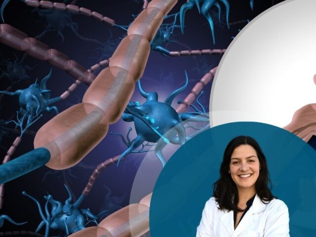 A Esclerose Múltipla (EM) continua a ser uma das doenças neurológicas mais desafiantes da medicina moderna. É uma doença autoimune em que o próprio sistema imunitário ataca a bainha de mielina que protege os nervos, provocando sintomas que vão da fadiga extrema a problemas de visão, de equilíbrio e de mobilidade. Afeta sobretudo adultos jovens, muitas vezes no início da vida profissional e familiar, e o seu curso é imprevisível. Os tratamentos disponíveis conseguem reduzir surtos e atrasar a progressão da doença, mas nenhum repara o dano já feito ao sistema nervoso. É aqui que as células do cordão umbilical têm vindo a ganhar espaço na investigação científica. O que mudou nos últimos anos O interesse por estas células não é novo, mas a evidência científica tem-se acumulado de forma consistente. Um dos primeiros marcos foi o relato, em 2013, de um doente com EM recorrente-remitente tratado com células mesenquimais de cordão umbilical e de medula óssea, que mostrou sinais de regeneração da bainha de mielina nas lesões cerebrais. Nos anos seguintes, surgiram os primeiros ensaios clínicos estruturados. Um dos mais citados é o estudo do Stem Cell Institute, no Panamá (NCT02034188), publicado em 2018 no Journal of Translational Medicine. Neste ensaio de fase I/II, vinte doentes com diferentes formas de EM receberam sete infusões intravenosas de células mesenquimais de cordão umbilical ao longo de uma semana e foram acompanhados durante um ano, com ressonâncias magnéticas, escalas de incapacidade (EDSS) e testes funcionais. Os resultados mostraram segurança, sem eventos adversos graves, e sinais de benefício clínico que justificaram continuar a investigação. Este não foi um caso isolado. Outros grupos, como o de Dahbour e colaboradores (2017), avaliaram também a segurança e a eficácia de células mesenquimais e de meios condicionados em doentes com EM, com resultados igualmente favoráveis do ponto de vista da segurança. Mais recentemente, a investigação tem entrado numa fase mais robusta e regulada. Estão atualmente a decorrer ensaios como o NCT05003388, nos Estados Unidos, a testar a segurança da infusão intravenosa de células mesenquimais de cordão umbilical em doentes com EM, e o NCT05532943 (UMSC01), um estudo de fase I/IIa que combina administração intratecal e intravenosa destas células, com conclusão prevista para 2028. O facto de estarmos a passar de relatos de caso isolados para ensaios multicêntricos, com fases regulatórias bem definidas, diz muito sobre a maturação deste campo. Porque fazem sentido as células do cordão umbilical O cordão umbilical — tanto o sangue como o tecido — é uma fonte particularmente interessante de células estaminais por várias razões. As células mesenquimais aí presentes têm propriedades anti-inflamatórias e imunomoduladoras bem documentadas, ou seja, ajudam a “acalmar” a resposta imunitária descontrolada que está na origem da EM. Ao contrário de outras fontes, como a medula óssea, a colheita do cordão umbilical não é invasiva para o dador nem para a mãe, e as células obtidas são geralmente mais jovens e com maior capacidade proliferativa. Isto é também o que torna a preservação de células do cordão umbilical, no momento do nascimento, uma decisão com um potencial que vai muito além do que se pensava há uma década. O que hoje é investigação em EM, doenças neurológicas, autoimunes e outras condições, pode amanhã traduzir-se em opções terapêuticas reais para essa criança ou para a sua família. Uma palavra de rigor Dito isto, é importante não criar expectativas desproporcionadas. Nenhum destes tratamentos está, para já, aprovado como terapêutica de rotina para a EM. Os ensaios existentes são, na sua maioria, pequenos, de fase inicial, e desenhados principalmente para avaliar segurança — a eficácia clínica sustentada ainda precisa de ser confirmada em estudos maiores, com grupos de controlo e seguimento mais longo. Uma revisão sistemática publicada em 2024 na Scientific Reports, que analisou nove ensaios clínicos randomizados sobre transplante de células estaminais em EM (a maioria com origem na medula óssea), reforça esta cautela: há resultados promissores, mas ainda com variabilidade relevante entre estudos. É esta combinação — entusiasmo justificado pela ciência, mas rigor na forma como comunicamos o que ela já demonstra — que deve orientar qualquer discurso público sobre este tema, especialmente quando vem de quem trabalha todos os dias com estas células. O caminho em aberto A EM continua sem cura, mas o caminho que a investigação com células do cordão umbilical tem percorrido nos últimos doze anos é notável: de relatos de caso isolados a ensaios internacionais multicêntricos, com dados de segurança sólidos e sinais de eficácia que justificam continuar a investir. Como laboratório que preserva estas células diariamente, sentimos a responsabilidade de acompanhar de perto esta evolução — e de a comunicar com honestidade, sem promessas prematuras, mas também sem subestimar o que está, de facto, a acontecer. O futuro da EM pode não passar apenas por travar a doença, mas por reparar o que ela destrói. As células do cordão umbilical são, hoje, um dos caminhos mais sérios que a ciência está a explorar nessa direção. Referências 1. Riordan, N.H., Morales, I., Fernández, G., et al. (2018). Clinical feasibility of umbilical cord tissue-derived mesenchymal stem cells in the treatment of multiple sclerosis. Journal of Translational Medicine, 16, 57. Ensaio clínico NCT02034188. 2. Hou, Z.L., Liu, Y., Mao, X.H., et al. (2013). Transplantation of umbilical cord and bone marrow-derived mesenchymal stem cells in a patient with relapsing-remitting multiple sclerosis. Cell Adhesion & Migration, 7, 404–407. 3. Dahbour, S., Jamali, F., Alhattab, D., et al. (2017). Mesenchymal stem cells and conditioned media in the treatment of multiple sclerosis patients: clinical, ophthalmological and radiological assessments of safety and efficacy. CNS Neuroscience & Therapeutics, 23, 866–874. 4. ClinicalTrials.gov. NCT05003388 — Safety of Cultured Allogeneic Adult Umbilical Cord Derived Mesenchymal Stem Cell Intravenous Infusion for the Treatment of Multiple Sclerosis.