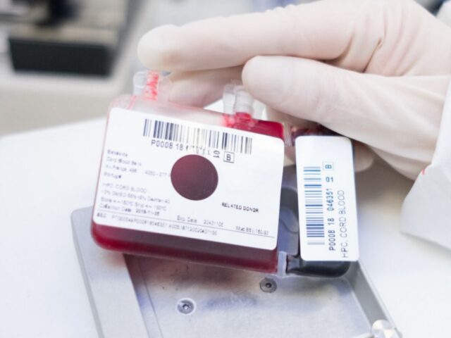 Expansão do sangue do cordão reforça potencial nos transplantes de células estaminais Um estudo publicado em 2025 na revista científica Transplantation and Cellular Therapy apresenta novos dados sobre a utilização de sangue do cordão umbilical expandido em laboratório em transplantes de células estaminais hematopoiéticas. Os investigadores compararam os resultados obtidos com sangue do cordão expandido através da tecnologia UM171 com seis outras fontes de células habitualmente utilizadas em transplante, concluindo que esta abordagem apresentou resultados equivalentes ou, em alguns parâmetros, mais favoráveis. O desafio da quantidade de células no sangue do cordão O sangue do cordão umbilical é uma importante fonte de células estaminais hematopoiéticas, capazes de dar origem às diferentes células do sangue e do sistema imunitário. Estas células são utilizadas há várias décadas no tratamento de diferentes doenças hematológicas. No entanto, uma das limitações associadas ao transplante de sangue do cordão, sobretudo em adultos, é a quantidade de células disponível numa única unidade. É precisamente neste ponto que a expansão celular pode assumir particular relevância. A UM171 é uma pequena molécula utilizada durante o processo de expansão ex vivo, ou seja, em laboratório, com o objetivo de aumentar o número de células estaminais e progenitoras hematopoiéticas antes do transplante. Em estudos clínicos anteriores, esta estratégia já tinha demonstrado ser capaz de expandir unidades de sangue do cordão de menor dimensão, permitindo a realização do transplante sem comprometer a enxertia. Comparação com seis fontes diferentes de células Neste novo trabalho, 22 adultos receberam um transplante com uma única unidade de sangue do cordão expandida com UM171. Os resultados foram depois comparados com dados de doentes registados na European Society for Blood and Marrow Transplantation (EBMT) que tinham recebido transplantes de sangue do cordão não expandido, medula óssea e células estaminais do sangue periférico provenientes de diferentes tipos de dadores. De acordo com os investigadores, os doentes transplantados com sangue do cordão expandido com UM171 apresentaram resultados a curto e longo prazo equivalentes ou superiores aos observados com outras fontes de células estaminais. No grupo que recebeu sangue do cordão expandido com UM171 não foram registados casos moderados a graves desta complicação, tendo sido observadas taxas significativamente inferiores às verificadas em alguns dos grupos de comparação. O estudo avaliou ainda parâmetros como a enxertia, mortalidade não relacionada com recaída, recaída da doença, sobrevivência global, sobrevivência livre de progressão e sobrevivência sem recaída nem GVHD. No conjunto, os resultados positivos reforçam a possibilidade de a expansão celular ajudar a ultrapassar uma das principais limitações históricas do sangue do cordão: a dose celular disponível para transplante. Novas possibilidades para o sangue do cordão A possibilidade de expandir células do sangue do cordão pode tornar utilizáveis unidades que, devido à sua menor quantidade inicial de células, poderiam não ser consideradas adequadas para determinados doentes. Esta evolução é particularmente relevante porque permite continuar a explorar as características próprias do sangue do cordão enquanto fonte de células estaminais hematopoiéticas, ao mesmo tempo que procura ultrapassar algumas das limitações associadas ao número inicial de células. Apesar dos resultados positivos, é importante salientar que este foi um estudo retrospetivo e com um número reduzido de doentes tratados com sangue do cordão expandido. Os resultados devem, por isso, continuar a ser confirmados através de estudos clínicos de maior dimensão. Ainda assim, esta investigação demonstra como a evolução das tecnologias de expansão celular pode abrir novas possibilidades para a utilização do sangue do cordão umbilical e reforça a importância da investigação contínua nesta área. Fonte: Cohen S. et al. Transplantation and Cellular Therapy, 2025. PMID: 40818826.