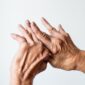Artrite reumatoide: células estaminais do cordão acompanhadas durante 5 anos Um estudo publicado em agosto de 2026 na revista científica Stem Cells Translational Medicine avaliou, durante cinco anos, a segurança da administração de células estaminais mesenquimais derivadas do sangue do cordão umbilical em pessoas com artrite reumatoide. Os resultados não identificaram novos sinais importantes de segurança associados à terapia celular durante o período de acompanhamento. A artrite reumatoide é uma doença inflamatória crónica e autoimune que afeta principalmente as articulações e que, ao longo do tempo, pode provocar lesões articulares e incapacidade. Apesar dos importantes avanços alcançados com os tratamentos atualmente disponíveis, algumas terapêuticas podem estar associadas a efeitos adversos significativos. Por esse motivo, a investigação continua a explorar novas abordagens, entre as quais as células estaminais mesenquimais, conhecidas pelas suas propriedades imunomoduladoras. Um acompanhamento ao longo de cinco anos O estudo acompanhou nove pessoas com artrite reumatoide que tinham participado anteriormente num ensaio clínico de fase I. Cada participante recebeu uma única administração intravenosa de células estaminais mesenquimais derivadas do sangue do cordão umbilical, em diferentes doses. Após a administração, os investigadores realizaram avaliações aos três, seis e doze meses e, posteriormente, todos os anos até completar cinco anos de acompanhamento. O principal objetivo foi perceber se poderiam surgir efeitos adversos relevantes a longo prazo. O que mostraram os resultados? Durante os cinco anos de acompanhamento, não foram registadas mortes, eventos tromboembólicos ou tumores malignos. Entre os acontecimentos adversos mais frequentes encontraram-se a osteoartrose e a nasofaringite. Foram também registados eventos adversos graves em alguns participantes, incluindo um caso de celulite — uma infeção da pele e tecidos subjacentes — que foi tratado e resolvido. Dois participantes desenvolveram tumores benignos, um do ovário e outro da mama, cerca de três anos após a administração. De acordo com os dados apresentados pelos investigadores, não foram identificados tumores malignos durante o período de acompanhamento. Globalmente, os autores consideram que uma única administração intravenosa destas células apresentou um perfil de segurança a longo prazo aceitável neste pequeno grupo de participantes. E quanto à evolução da artrite reumatoide? Embora o objetivo principal deste estudo fosse avaliar a segurança, os investigadores acompanharam também a atividade da doença. Nos primeiros três a seis meses após a administração das células foi observada uma melhoria marcada no índice utilizado para avaliar a atividade da artrite reumatoide, o DAS28. Contudo, ao longo dos cinco anos seguintes, a atividade da doença voltou gradualmente a aumentar. Estes resultados sugerem que o eventual efeito observado após uma única administração poderá diminuir com o tempo. Os investigadores levantam, por isso, a hipótese de que futuros estudos possam avaliar esquemas com administrações repetidas. Porque são estudadas as células estaminais mesenquimais? As células estaminais mesenquimais têm despertado interesse na investigação de doenças autoimunes sobretudo devido às suas propriedades imunomoduladoras. Em vez de atuarem apenas através da substituição de células danificadas, estas células podem interagir com diferentes componentes do sistema imunitário e influenciar processos relacionados com a inflamação. As células mesenquimais podem ser obtidas a partir de diferentes tecidos. Neste estudo, foram utilizadas especificamente células estaminais mesenquimais derivadas do sangue do cordão umbilical, cuja recolha é não invasiva e que apresentam características que têm motivado a sua investigação em diferentes áreas da medicina regenerativa. Resultados promissores, mas que exigem mais investigação Este estudo acrescenta informação particularmente relevante por acompanhar os participantes durante cinco anos, um período ainda pouco representado nos estudos clínicos com este tipo de terapia celular. No entanto, os próprios investigadores salientam as limitações do trabalho. O estudo incluiu apenas nove participantes, teve carácter exploratório e observacional e não contou com um grupo de controlo durante este acompanhamento. Assim, estes resultados não demonstram que as células estaminais do sangue do cordão umbilical sejam atualmente um tratamento comprovado para a artrite reumatoide. São, contudo, dados importantes sobre a segurança a longo prazo desta abordagem e constituem uma base para estudos futuros, com maior número de participantes e desenhos clínicos controlados. A investigação continua, assim, a explorar o potencial das células estaminais do cordão umbilical em novas áreas terapêuticas e a procurar compreender de que forma as suas propriedades poderão ser utilizadas de forma segura e eficaz no futuro.