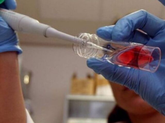 Células do cordão umbilical no tratamento da GVHD A investigação com células provenientes do cordão umbilical continua a abrir novas possibilidades na medicina. Um estudo publicado em 2026 avaliou células mesenquimais derivadas do tecido do cordão umbilical como parte de uma estratégia terapêutica para uma das complicações mais graves que pode surgir após determinados transplantes de células estaminais hematopoiéticas: a doença do enxerto contra o hospedeiro. Os resultados são encorajadores e contribuem para aumentar o interesse científico nas células mesenquimais do cordão umbilical, sobretudo pelas suas propriedades imunomoduladoras. Para os futuros pais, estes avanços são também uma forma de compreender melhor o potencial que a investigação atribui aos diferentes componentes do cordão umbilical — incluindo o sangue e o tecido do cordão — e o motivo pelo qual a sua preservação tem vindo a ser estudada para possíveis aplicações médicas. O que é a doença do enxerto contra o hospedeiro? A doença do enxerto contra o hospedeiro, frequentemente conhecida pela sigla GVHD (Graft-versus-Host Disease), é uma complicação que pode ocorrer depois de um transplante alogénico de células estaminais hematopoiéticas. Nestes transplantes, as células imunitárias provenientes do dador podem reconhecer os tecidos do doente como estranhos e desencadear uma resposta imunitária contra o organismo do recetor. A GVHD pode afetar vários órgãos, nomeadamente a pele, o fígado e o sistema gastrointestinal. Nas formas mais graves, pode tornar-se uma complicação potencialmente fatal. O tratamento inicial é habitualmente feito com corticosteroides. No entanto, alguns doentes não respondem adequadamente ou deixam de responder ao tratamento. Nestes casos, fala-se em GVHD resistente ou dependente de corticosteroides, uma situação para a qual continuam a ser procuradas novas opções terapêuticas. Porque estão a ser estudadas as células mesenquimais do cordão? O tecido do cordão umbilical é uma fonte rica de células estaminais mesenquimais. Estas células têm despertado interesse científico devido às suas propriedades imunomoduladoras. Em termos simples, podem interagir com diferentes células do sistema imunitário e ajudar a regular respostas inflamatórias. Esta característica é particularmente relevante em doenças em que o sistema imunitário se encontra excessivamente ativado, como acontece na GVHD. As células mesenquimais também têm sido estudadas pela sua possível participação em mecanismos relacionados com a reparação e regeneração dos tecidos. É importante, contudo, distinguir entre o que já está clinicamente estabelecido e aquilo que permanece em investigação. Muitas das potenciais aplicações das células mesenquimais continuam a ser objeto de estudos clínicos. Resultados de ensaio clínico publicado em 2026 Em março de 2026, foram publicados na revista científica Stem Cell Research & Therapy os resultados de um ensaio clínico multicêntrico que avaliou uma abordagem terapêutica baseada em células mesenquimais humanas derivadas do cordão umbilical. O estudo incluiu 54 doentes, com idades entre os 14 e os 68 anos, que apresentavam GVHD aguda com envolvimento gastrointestinal e que eram resistentes ou dependentes de corticosteroides. Os participantes receberam PLEB001, um produto constituído por células mesenquimais derivadas do cordão umbilical, em associação com uma terapêutica imunossupressora baseada num anticorpo anti-CD25. O tratamento foi administrado por via intravenosa, duas vezes por semana durante quatro semanas. Nos doentes que apresentavam uma resposta parcial, o tratamento podia ser prolongado por mais quatro semanas. Que resultados foram observados? Ao 28.º dia, foi observada uma taxa global de resposta de 63%. Entre os participantes: 55,6% apresentaram uma resposta completa; 7,4% apresentaram uma resposta parcial; 51,9% mantinham uma resposta completa duradoura, de acordo com os critérios utilizados no estudo. Ao 56.º dia, a taxa global de resposta era de 51,9%, com 50% dos participantes a apresentarem uma resposta completa. No que diz respeito à sobrevivência global, os valores reportados foram de aproximadamente: 79,6% aos 100 dias; 65,8% aos 360 dias. Os investigadores consideraram igualmente aceitável o perfil de segurança observado, não tendo sido registadas toxicidades associadas à infusão nem acontecimentos adversos graves considerados relacionados com o tratamento. O que significam estes resultados? Os resultados são relevantes, mas devem ser interpretados com algum cuidado. Uma das principais limitações é que todos os participantes receberam as células mesenquimais em associação com a terapêutica anti-CD25. Por isso, este estudo, isoladamente, não permite determinar qual foi a contribuição específica das células mesenquimais para os resultados observados. Os resultados dão, contudo, continuidade a investigação clínica anterior. Num ensaio de fase II, randomizado e controlado, a combinação de células mesenquimais com terapêutica anti-CD25 tinha demonstrado melhores respostas do que a utilização de anti-CD25 sem as células mesenquimais. Os resultados observados em doentes com GVHD são promissores e apoiam a continuidade da investigação sobre as propriedades imunomoduladoras das células mesenquimais. Ao mesmo tempo, são necessários mais estudos para determinar com maior precisão quais os doentes que mais podem beneficiar, qual o papel específico das células mesenquimais e como esta abordagem se compara com outras terapêuticas disponíveis.