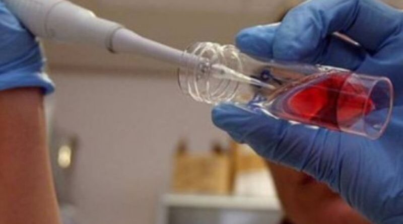 Células do cordão umbilical no tratamento da GVHD A investigação com células provenientes do cordão umbilical continua a abrir novas possibilidades na medicina. Um estudo publicado em 2026 avaliou células mesenquimais derivadas do tecido do cordão umbilical como parte de uma estratégia terapêutica para uma das complicações mais graves que pode surgir após determinados transplantes de células estaminais hematopoiéticas: a doença do enxerto contra o hospedeiro. Os resultados são encorajadores e contribuem para aumentar o interesse científico nas células mesenquimais do cordão umbilical, sobretudo pelas suas propriedades imunomoduladoras. Para os futuros pais, estes avanços são também uma forma de compreender melhor o potencial que a investigação atribui aos diferentes componentes do cordão umbilical — incluindo o sangue e o tecido do cordão — e o motivo pelo qual a sua preservação tem vindo a ser estudada para possíveis aplicações médicas. O que é a doença do enxerto contra o hospedeiro? A doença do enxerto contra o hospedeiro, frequentemente conhecida pela sigla GVHD (Graft-versus-Host Disease), é uma complicação que pode ocorrer depois de um transplante alogénico de células estaminais hematopoiéticas. Nestes transplantes, as células imunitárias provenientes do dador podem reconhecer os tecidos do doente como estranhos e desencadear uma resposta imunitária contra o organismo do recetor. A GVHD pode afetar vários órgãos, nomeadamente a pele, o fígado e o sistema gastrointestinal. Nas formas mais graves, pode tornar-se uma complicação potencialmente fatal. O tratamento inicial é habitualmente feito com corticosteroides. No entanto, alguns doentes não respondem adequadamente ou deixam de responder ao tratamento. Nestes casos, fala-se em GVHD resistente ou dependente de corticosteroides, uma situação para a qual continuam a ser procuradas novas opções terapêuticas. Porque estão a ser estudadas as células mesenquimais do cordão? O tecido do cordão umbilical é uma fonte rica de células estaminais mesenquimais. Estas células têm despertado interesse científico devido às suas propriedades imunomoduladoras. Em termos simples, podem interagir com diferentes células do sistema imunitário e ajudar a regular respostas inflamatórias. Esta característica é particularmente relevante em doenças em que o sistema imunitário se encontra excessivamente ativado, como acontece na GVHD. As células mesenquimais também têm sido estudadas pela sua possível participação em mecanismos relacionados com a reparação e regeneração dos tecidos. É importante, contudo, distinguir entre o que já está clinicamente estabelecido e aquilo que permanece em investigação. Muitas das potenciais aplicações das células mesenquimais continuam a ser objeto de estudos clínicos. Resultados de ensaio clínico publicado em 2026 Em março de 2026, foram publicados na revista científica Stem Cell Research & Therapy os resultados de um ensaio clínico multicêntrico que avaliou uma abordagem terapêutica baseada em células mesenquimais humanas derivadas do cordão umbilical. O estudo incluiu 54 doentes, com idades entre os 14 e os 68 anos, que apresentavam GVHD aguda com envolvimento gastrointestinal e que eram resistentes ou dependentes de corticosteroides. Os participantes receberam PLEB001, um produto constituído por células mesenquimais derivadas do cordão umbilical, em associação com uma terapêutica imunossupressora baseada num anticorpo anti-CD25. O tratamento foi administrado por via intravenosa, duas vezes por semana durante quatro semanas. Nos doentes que apresentavam uma resposta parcial, o tratamento podia ser prolongado por mais quatro semanas. Que resultados foram observados? Ao 28.º dia, foi observada uma taxa global de resposta de 63%. Entre os participantes: 55,6% apresentaram uma resposta completa; 7,4% apresentaram uma resposta parcial; 51,9% mantinham uma resposta completa duradoura, de acordo com os critérios utilizados no estudo. Ao 56.º dia, a taxa global de resposta era de 51,9%, com 50% dos participantes a apresentarem uma resposta completa. No que diz respeito à sobrevivência global, os valores reportados foram de aproximadamente: 79,6% aos 100 dias; 65,8% aos 360 dias. Os investigadores consideraram igualmente aceitável o perfil de segurança observado, não tendo sido registadas toxicidades associadas à infusão nem acontecimentos adversos graves considerados relacionados com o tratamento. O que significam estes resultados? Os resultados são relevantes, mas devem ser interpretados com algum cuidado. Uma das principais limitações é que todos os participantes receberam as células mesenquimais em associação com a terapêutica anti-CD25. Por isso, este estudo, isoladamente, não permite determinar qual foi a contribuição específica das células mesenquimais para os resultados observados. Os resultados dão, contudo, continuidade a investigação clínica anterior. Num ensaio de fase II, randomizado e controlado, a combinação de células mesenquimais com terapêutica anti-CD25 tinha demonstrado melhores respostas do que a utilização de anti-CD25 sem as células mesenquimais. Os resultados observados em doentes com GVHD são promissores e apoiam a continuidade da investigação sobre as propriedades imunomoduladoras das células mesenquimais. Ao mesmo tempo, são necessários mais estudos para determinar com maior precisão quais os doentes que mais podem beneficiar, qual o papel específico das células mesenquimais e como esta abordagem se compara com outras terapêuticas disponíveis.