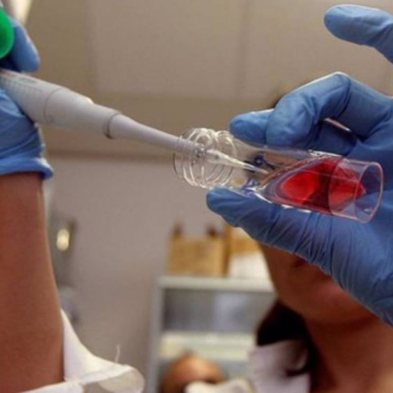 Células do cordão umbilical no tratamento da GVHD A investigação com células provenientes do cordão umbilical continua a abrir novas possibilidades na medicina. Um estudo publicado em 2026 avaliou células mesenquimais derivadas do tecido do cordão umbilical como parte de uma estratégia terapêutica para uma das complicações mais graves que pode surgir após determinados transplantes de células estaminais hematopoiéticas: a doença do enxerto contra o hospedeiro. Os resultados são encorajadores e contribuem para aumentar o interesse científico nas células mesenquimais do cordão umbilical, sobretudo pelas suas propriedades imunomoduladoras. Para os futuros pais, estes avanços são também uma forma de compreender melhor o potencial que a investigação atribui aos diferentes componentes do cordão umbilical — incluindo o sangue e o tecido do cordão — e o motivo pelo qual a sua preservação tem vindo a ser estudada para possíveis aplicações médicas. O que é a doença do enxerto contra o hospedeiro? A doença do enxerto contra o hospedeiro, frequentemente conhecida pela sigla GVHD (Graft-versus-Host Disease), é uma complicação que pode ocorrer depois de um transplante alogénico de células estaminais hematopoiéticas. Nestes transplantes, as células imunitárias provenientes do dador podem reconhecer os tecidos do doente como estranhos e desencadear uma resposta imunitária contra o organismo do recetor. A GVHD pode afetar vários órgãos, nomeadamente a pele, o fígado e o sistema gastrointestinal. Nas formas mais graves, pode tornar-se uma complicação potencialmente fatal. O tratamento inicial é habitualmente feito com corticosteroides. No entanto, alguns doentes não respondem adequadamente ou deixam de responder ao tratamento. Nestes casos, fala-se em GVHD resistente ou dependente de corticosteroides, uma situação para a qual continuam a ser procuradas novas opções terapêuticas. Porque estão a ser estudadas as células mesenquimais do cordão? O tecido do cordão umbilical é uma fonte rica de células estaminais mesenquimais. Estas células têm despertado interesse científico devido às suas propriedades imunomoduladoras. Em termos simples, podem interagir com diferentes células do sistema imunitário e ajudar a regular respostas inflamatórias. Esta característica é particularmente relevante em doenças em que o sistema imunitário se encontra excessivamente ativado, como acontece na GVHD. As células mesenquimais também têm sido estudadas pela sua possível participação em mecanismos relacionados com a reparação e regeneração dos tecidos. É importante, contudo, distinguir entre o que já está clinicamente estabelecido e aquilo que permanece em investigação. Muitas das potenciais aplicações das células mesenquimais continuam a ser objeto de estudos clínicos. Resultados de ensaio clínico publicado em 2026 Em março de 2026, foram publicados na revista científica Stem Cell Research & Therapy os resultados de um ensaio clínico multicêntrico que avaliou uma abordagem terapêutica baseada em células mesenquimais humanas derivadas do cordão umbilical. O estudo incluiu 54 doentes, com idades entre os 14 e os 68 anos, que apresentavam GVHD aguda com envolvimento gastrointestinal e que eram resistentes ou dependentes de corticosteroides. Os participantes receberam PLEB001, um produto constituído por células mesenquimais derivadas do cordão umbilical, em associação com uma terapêutica imunossupressora baseada num anticorpo anti-CD25. O tratamento foi administrado por via intravenosa, duas vezes por semana durante quatro semanas. Nos doentes que apresentavam uma resposta parcial, o tratamento podia ser prolongado por mais quatro semanas. Que resultados foram observados? Ao 28.º dia, foi observada uma taxa global de resposta de 63%. Entre os participantes: 55,6% apresentaram uma resposta completa; 7,4% apresentaram uma resposta parcial; 51,9% mantinham uma resposta completa duradoura, de acordo com os critérios utilizados no estudo. Ao 56.º dia, a taxa global de resposta era de 51,9%, com 50% dos participantes a apresentarem uma resposta completa. No que diz respeito à sobrevivência global, os valores reportados foram de aproximadamente: 79,6% aos 100 dias; 65,8% aos 360 dias. Os investigadores consideraram igualmente aceitável o perfil de segurança observado, não tendo sido registadas toxicidades associadas à infusão nem acontecimentos adversos graves considerados relacionados com o tratamento. O que significam estes resultados? Os resultados são relevantes, mas devem ser interpretados com algum cuidado. Uma das principais limitações é que todos os participantes receberam as células mesenquimais em associação com a terapêutica anti-CD25. Por isso, este estudo, isoladamente, não permite determinar qual foi a contribuição específica das células mesenquimais para os resultados observados. Os resultados dão, contudo, continuidade a investigação clínica anterior. Num ensaio de fase II, randomizado e controlado, a combinação de células mesenquimais com terapêutica anti-CD25 tinha demonstrado melhores respostas do que a utilização de anti-CD25 sem as células mesenquimais. Os resultados observados em doentes com GVHD são promissores e apoiam a continuidade da investigação sobre as propriedades imunomoduladoras das células mesenquimais. Ao mesmo tempo, são necessários mais estudos para determinar com maior precisão quais os doentes que mais podem beneficiar, qual o papel específico das células mesenquimais e como esta abordagem se compara com outras terapêuticas disponíveis.