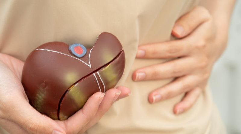 Células do cordão umbilical estudadas na cirrose hepática Um estudo clínico publicado em maio de 2026 na revista científica Cell Transplantation avaliou a segurança e os potenciais benefícios da utilização de células estaminais mesenquimais derivadas do cordão umbilical em pessoas com cirrose hepática. Os resultados demonstraram que a administração destas células foi bem tolerada pelos participantes e permitiram identificar alguns sinais preliminares de melhoria de parâmetros relacionados com a função hepática e a qualidade de vida. Uma doença com opções terapêuticas limitadas A cirrose hepática representa uma fase avançada da doença crónica do fígado. Caracteriza-se pela formação progressiva de fibrose, alterações da estrutura normal do órgão e perda da sua capacidade funcional. Entre as principais causas encontram-se a doença hepática associada ao consumo de álcool, a doença hepática esteatótica associada a disfunção metabólica e as hepatites virais B e C. Nas fases mais avançadas, a cirrose pode originar complicações graves e, atualmente, o transplante hepático continua a ser uma das principais opções terapêuticas para os casos de doença hepática terminal. É neste contexto que a medicina regenerativa tem vindo a estudar novas abordagens, incluindo a utilização de células estaminais mesenquimais. Células estaminais mesenquimais do cordão umbilical As células estaminais mesenquimais derivadas do cordão umbilical, designadas UC-MSCs, têm despertado interesse científico pelas suas propriedades imunomoduladoras e pela sua possível capacidade de contribuir para processos de reparação dos tecidos. Estudos pré-clínicos anteriores sugeriram que estas células podem exercer efeitos anti-inflamatórios e antifibróticos, mecanismos particularmente relevantes numa doença caracterizada pela inflamação crónica e acumulação progressiva de tecido fibroso no fígado. Os investigadores referem ainda que estas células poderão atuar através da modulação da resposta imunitária, redução de mediadores inflamatórios e promoção de mecanismos associados à reparação hepática. Um ensaio clínico de fase I O novo estudo correspondeu a um ensaio clínico de fase I, aberto e de braço único, realizado no Vinmec Times City International Hospital, em Hanói, Vietname. Participaram 20 pessoas com cirrose hepática. Todos os participantes receberam uma única administração de células estaminais mesenquimais alogénicas derivadas do cordão umbilical, numa dose de: 1 milhão de células por quilograma de peso corporal. Uma das particularidades deste estudo foi a via utilizada para administrar as células. Em vez da administração intravenosa convencional, as células foram introduzidas diretamente através da artéria hepática, permitindo a sua administração direcionada para o fígado. Segundo os investigadores, esta abordagem com células estaminais mesenquimais do cordão umbilical através da artéria hepática ainda tinha sido pouco estudada em pessoas com fibrose ou cirrose hepática. Acompanhamento durante 12 meses Os participantes foram avaliados antes da administração das células e posteriormente aos 3, 6 e 12 meses. Dos 20 participantes inicialmente incluídos, 17 completaram o acompanhamento de 12 meses e foram considerados nas análises exploratórias de eficácia. Administração considerada segura e bem tolerada O principal objetivo de um ensaio clínico de fase I é avaliar a segurança de uma nova abordagem terapêutica. Neste estudo, não foram registados acontecimentos adversos graves relacionados com o procedimento. Os efeitos adversos observados foram ligeiros e autolimitados, resolvendo-se espontaneamente ou necessitando apenas de tratamento mínimo. A administração das células através da artéria hepática foi realizada com sucesso em todos os participantes. Os investigadores consideraram, por isso, que esta forma de administração das células estaminais mesenquimais do cordão umbilical foi tecnicamente viável e bem tolerada neste grupo de doentes. Aumento dos níveis de albumina Para além da segurança, o estudo avaliou de forma exploratória possíveis alterações relacionadas com a função hepática. Um dos resultados mais interessantes foi observado nos níveis de albumina, uma proteína produzida pelo fígado e frequentemente utilizada como indicador da sua capacidade funcional. Os níveis de albumina aumentaram significativamente aos 3 meses após a administração das células e aos 6 meses após o tratamento. A diferença foi estatisticamente significativa nos dois momentos de avaliação. Por outro lado, parâmetros como a bilirrubina, as enzimas hepáticas, a coagulação e a pontuação MELD permaneceram globalmente estáveis ao longo do acompanhamento. Melhoria temporária na classificação Child-Pugh Os investigadores avaliaram também a classificação Child-Pugh, utilizada para avaliar a gravidade da doença hepática crónica. Foi observada uma diminuição significativa desta pontuação aos 3 meses após a administração das células, sugerindo uma melhoria temporária da função hepática. Contudo, essa diferença não se manteve de forma estatisticamente significativa nos momentos posteriores de acompanhamento. Por esse motivo, os resultados devem ser interpretados como preliminares e não permitem concluir que a terapia tenha provocado uma melhoria clínica sustentada da cirrose. Resultados promissores, mas ainda preliminares Apesar dos resultados positivos relativamente à segurança e de alguns sinais favoráveis observados nos parâmetros clínicos, os próprios investigadores destacam várias limitações importantes. O estudo envolveu apenas 20 participantes, dos quais 17 completaram o acompanhamento, e não incluiu um grupo de controlo. Além disso, por se tratar de um ensaio clínico de fase I, o estudo foi concebido principalmente para avaliar segurança e viabilidade, e não para demonstrar definitivamente a eficácia do tratamento. Desta forma, os resultados não significam que as células estaminais do cordão umbilical constituam atualmente um tratamento comprovado para a cirrose hepática. São necessários ensaios clínicos controlados, com um maior número de participantes e períodos de acompanhamento mais longos, para confirmar os resultados e determinar o verdadeiro benefício clínico desta abordagem. O potencial das células do cordão umbilical continua em investigação Este estudo acrescenta novos dados à investigação internacional sobre o potencial das células estaminais mesenquimais derivadas do cordão umbilical. As suas propriedades imunomoduladoras, anti-inflamatórias e antifibróticas continuam a ser investigadas em várias áreas da medicina regenerativa. A investigação científica continua, assim, a revelar novas possibilidades de aplicação das células provenientes do cordão umbilical muito além das utilizações já estabelecidas.