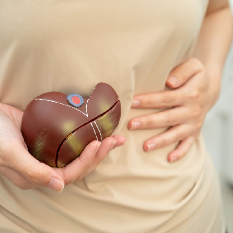 Células do cordão umbilical estudadas na cirrose hepática Um estudo clínico publicado em maio de 2026 na revista científica Cell Transplantation avaliou a segurança e os potenciais benefícios da utilização de células estaminais mesenquimais derivadas do cordão umbilical em pessoas com cirrose hepática. Os resultados demonstraram que a administração destas células foi bem tolerada pelos participantes e permitiram identificar alguns sinais preliminares de melhoria de parâmetros relacionados com a função hepática e a qualidade de vida. Uma doença com opções terapêuticas limitadas A cirrose hepática representa uma fase avançada da doença crónica do fígado. Caracteriza-se pela formação progressiva de fibrose, alterações da estrutura normal do órgão e perda da sua capacidade funcional. Entre as principais causas encontram-se a doença hepática associada ao consumo de álcool, a doença hepática esteatótica associada a disfunção metabólica e as hepatites virais B e C. Nas fases mais avançadas, a cirrose pode originar complicações graves e, atualmente, o transplante hepático continua a ser uma das principais opções terapêuticas para os casos de doença hepática terminal. É neste contexto que a medicina regenerativa tem vindo a estudar novas abordagens, incluindo a utilização de células estaminais mesenquimais. Células estaminais mesenquimais do cordão umbilical As células estaminais mesenquimais derivadas do cordão umbilical, designadas UC-MSCs, têm despertado interesse científico pelas suas propriedades imunomoduladoras e pela sua possível capacidade de contribuir para processos de reparação dos tecidos. Estudos pré-clínicos anteriores sugeriram que estas células podem exercer efeitos anti-inflamatórios e antifibróticos, mecanismos particularmente relevantes numa doença caracterizada pela inflamação crónica e acumulação progressiva de tecido fibroso no fígado. Os investigadores referem ainda que estas células poderão atuar através da modulação da resposta imunitária, redução de mediadores inflamatórios e promoção de mecanismos associados à reparação hepática. Um ensaio clínico de fase I O novo estudo correspondeu a um ensaio clínico de fase I, aberto e de braço único, realizado no Vinmec Times City International Hospital, em Hanói, Vietname. Participaram 20 pessoas com cirrose hepática. Todos os participantes receberam uma única administração de células estaminais mesenquimais alogénicas derivadas do cordão umbilical, numa dose de: 1 milhão de células por quilograma de peso corporal. Uma das particularidades deste estudo foi a via utilizada para administrar as células. Em vez da administração intravenosa convencional, as células foram introduzidas diretamente através da artéria hepática, permitindo a sua administração direcionada para o fígado. Segundo os investigadores, esta abordagem com células estaminais mesenquimais do cordão umbilical através da artéria hepática ainda tinha sido pouco estudada em pessoas com fibrose ou cirrose hepática. Acompanhamento durante 12 meses Os participantes foram avaliados antes da administração das células e posteriormente aos 3, 6 e 12 meses. Dos 20 participantes inicialmente incluídos, 17 completaram o acompanhamento de 12 meses e foram considerados nas análises exploratórias de eficácia. Administração considerada segura e bem tolerada O principal objetivo de um ensaio clínico de fase I é avaliar a segurança de uma nova abordagem terapêutica. Neste estudo, não foram registados acontecimentos adversos graves relacionados com o procedimento. Os efeitos adversos observados foram ligeiros e autolimitados, resolvendo-se espontaneamente ou necessitando apenas de tratamento mínimo. A administração das células através da artéria hepática foi realizada com sucesso em todos os participantes. Os investigadores consideraram, por isso, que esta forma de administração das células estaminais mesenquimais do cordão umbilical foi tecnicamente viável e bem tolerada neste grupo de doentes. Aumento dos níveis de albumina Para além da segurança, o estudo avaliou de forma exploratória possíveis alterações relacionadas com a função hepática. Um dos resultados mais interessantes foi observado nos níveis de albumina, uma proteína produzida pelo fígado e frequentemente utilizada como indicador da sua capacidade funcional. Os níveis de albumina aumentaram significativamente aos 3 meses após a administração das células e aos 6 meses após o tratamento. A diferença foi estatisticamente significativa nos dois momentos de avaliação. Por outro lado, parâmetros como a bilirrubina, as enzimas hepáticas, a coagulação e a pontuação MELD permaneceram globalmente estáveis ao longo do acompanhamento. Melhoria temporária na classificação Child-Pugh Os investigadores avaliaram também a classificação Child-Pugh, utilizada para avaliar a gravidade da doença hepática crónica. Foi observada uma diminuição significativa desta pontuação aos 3 meses após a administração das células, sugerindo uma melhoria temporária da função hepática. Contudo, essa diferença não se manteve de forma estatisticamente significativa nos momentos posteriores de acompanhamento. Por esse motivo, os resultados devem ser interpretados como preliminares e não permitem concluir que a terapia tenha provocado uma melhoria clínica sustentada da cirrose. Resultados promissores, mas ainda preliminares Apesar dos resultados positivos relativamente à segurança e de alguns sinais favoráveis observados nos parâmetros clínicos, os próprios investigadores destacam várias limitações importantes. O estudo envolveu apenas 20 participantes, dos quais 17 completaram o acompanhamento, e não incluiu um grupo de controlo. Além disso, por se tratar de um ensaio clínico de fase I, o estudo foi concebido principalmente para avaliar segurança e viabilidade, e não para demonstrar definitivamente a eficácia do tratamento. Desta forma, os resultados não significam que as células estaminais do cordão umbilical constituam atualmente um tratamento comprovado para a cirrose hepática. São necessários ensaios clínicos controlados, com um maior número de participantes e períodos de acompanhamento mais longos, para confirmar os resultados e determinar o verdadeiro benefício clínico desta abordagem. O potencial das células do cordão umbilical continua em investigação Este estudo acrescenta novos dados à investigação internacional sobre o potencial das células estaminais mesenquimais derivadas do cordão umbilical. As suas propriedades imunomoduladoras, anti-inflamatórias e antifibróticas continuam a ser investigadas em várias áreas da medicina regenerativa. A investigação científica continua, assim, a revelar novas possibilidades de aplicação das células provenientes do cordão umbilical muito além das utilizações já estabelecidas.